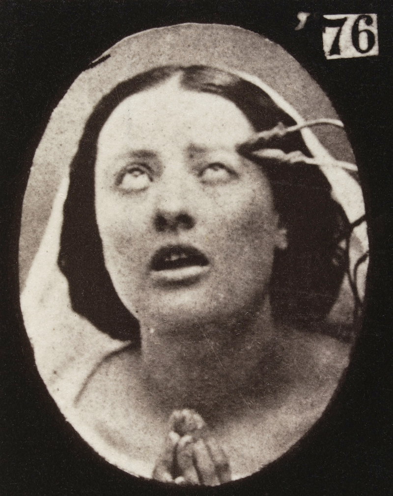 Illustration for article titled Terrifying, Century-Old Photographs from Neuroscience Experiments